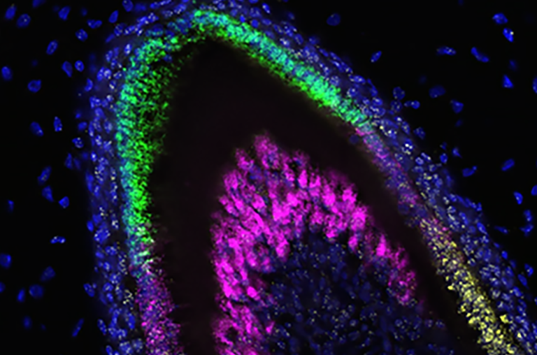 Organoid