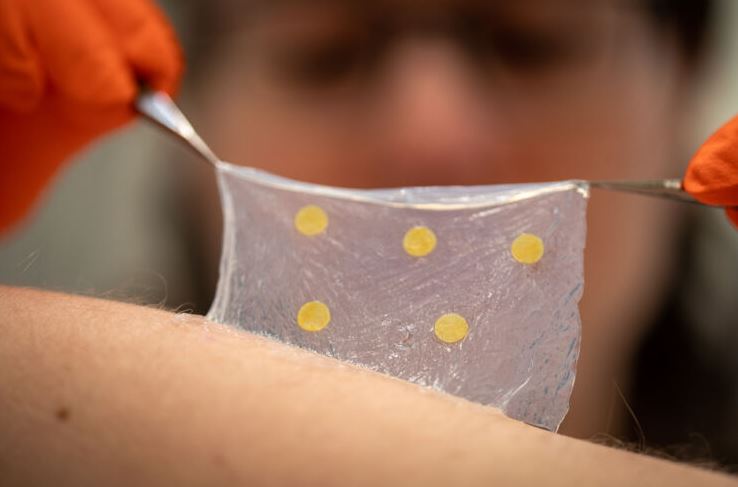 Wound Dressing